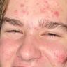 Jett Gritzenbach